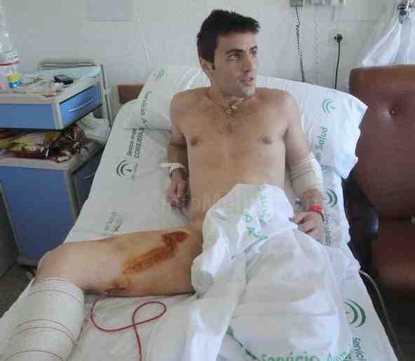 Antonio Criado Luque 'El Goy' recibe el alta médica y ya quiere tentar vacas bravas