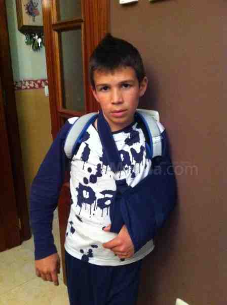Borja Martin, nuestro jovencísimo piloto con su lesión de clavícula