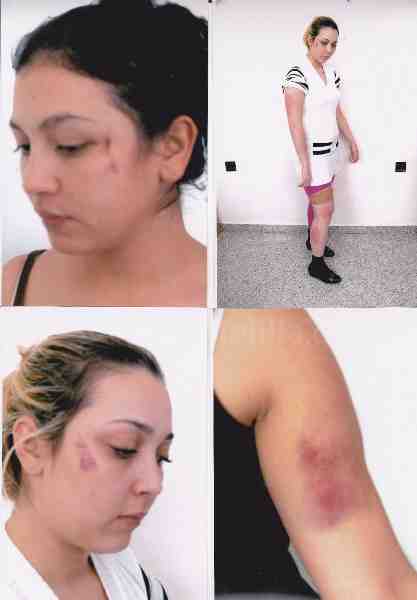 Gran Rif de Derechos Humanos denuncia la agresión padecida por una melillense en Nador