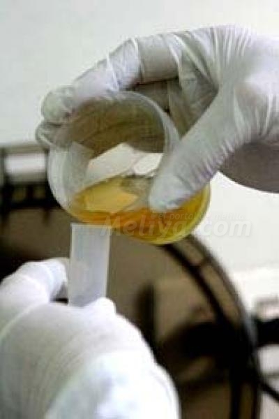 Diabéticos, mejor la prueba de la sangre