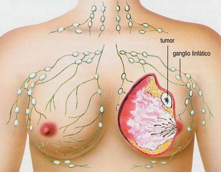 La crisis no puede frenar la investigación en el tratamiento y cura del cáncer